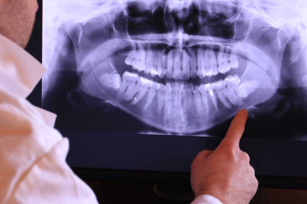 Best Emergency Dental Care for Sports Injuries in North Tunica, MS
